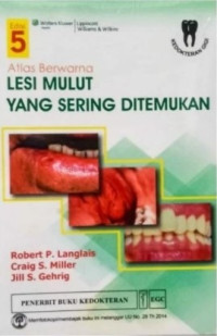 Image of Atlas Berwarna Lesi Mulut yang Sering Ditemukan