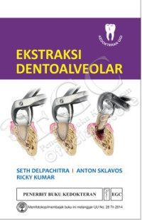 Image of Ekstrasi Dentoalveolar