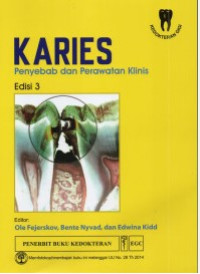 Image of Karies : Penyebab dan Perawatan Klinis