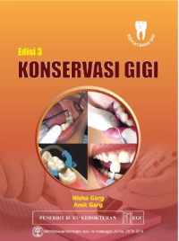 Image of Konservasi Gigi