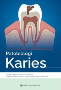 Image of Patobiologi Karies